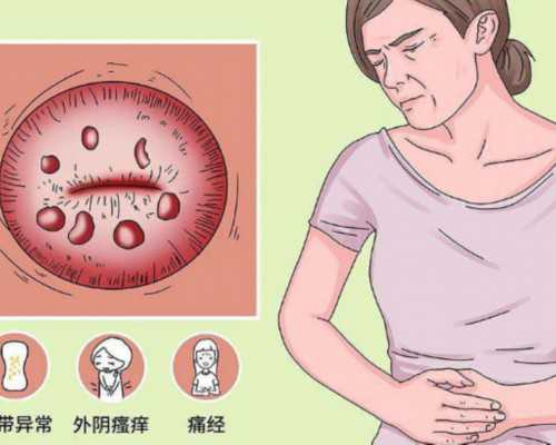 常用促排卵药物