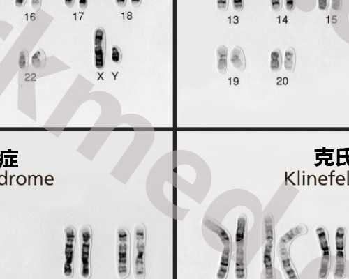 36岁做试管成功率多少&试管能选性别吗,孕期预激综合征是什么病