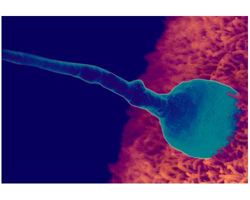国内供卵不用等的医院有哪些&卵巢早衰做供卵试管,怀孕期霉菌感染是怎么引起